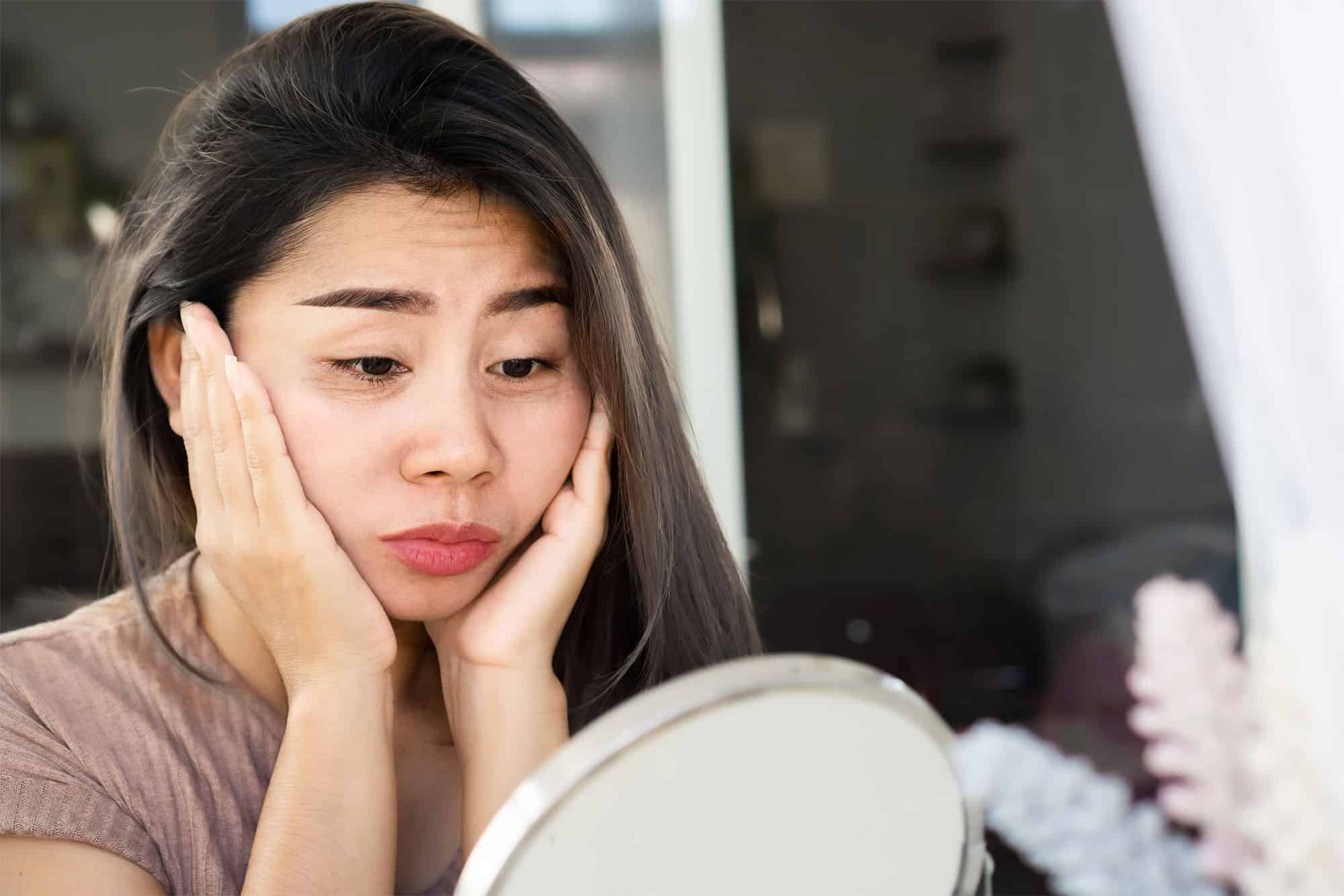Image of Dark Circles & Hollows