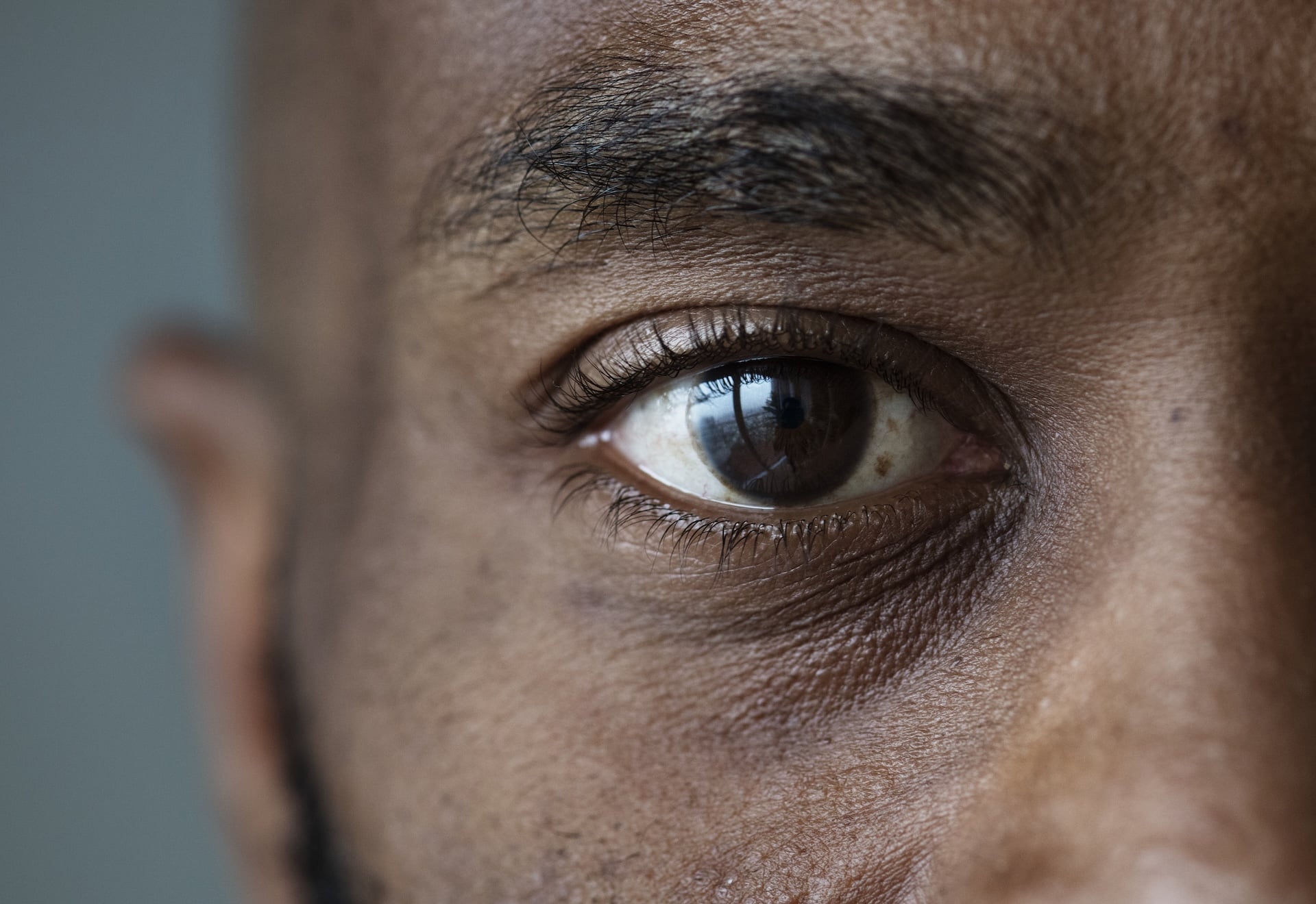 Image of Chronic Blepharospasm