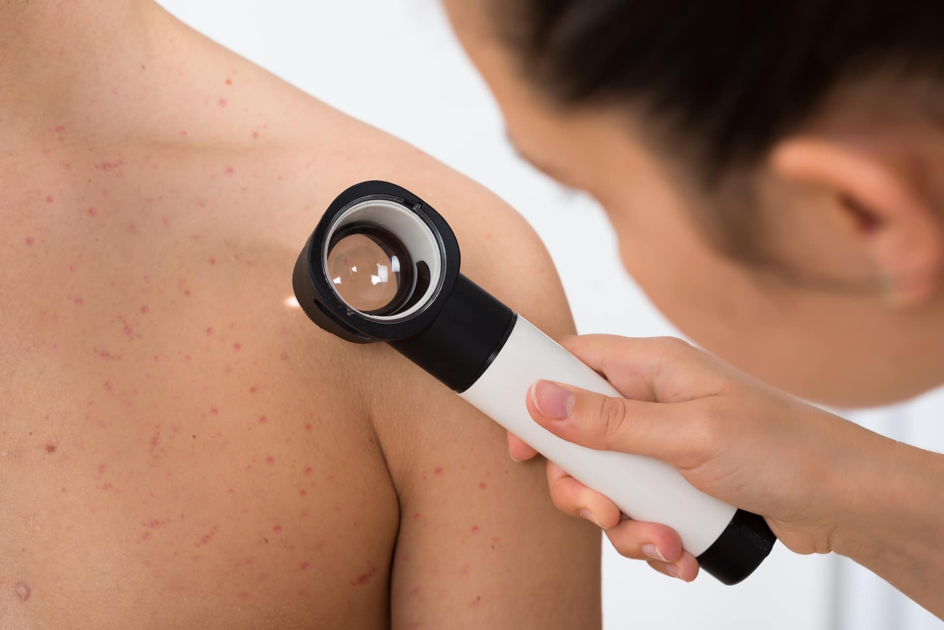 Image of Skin Surveillance