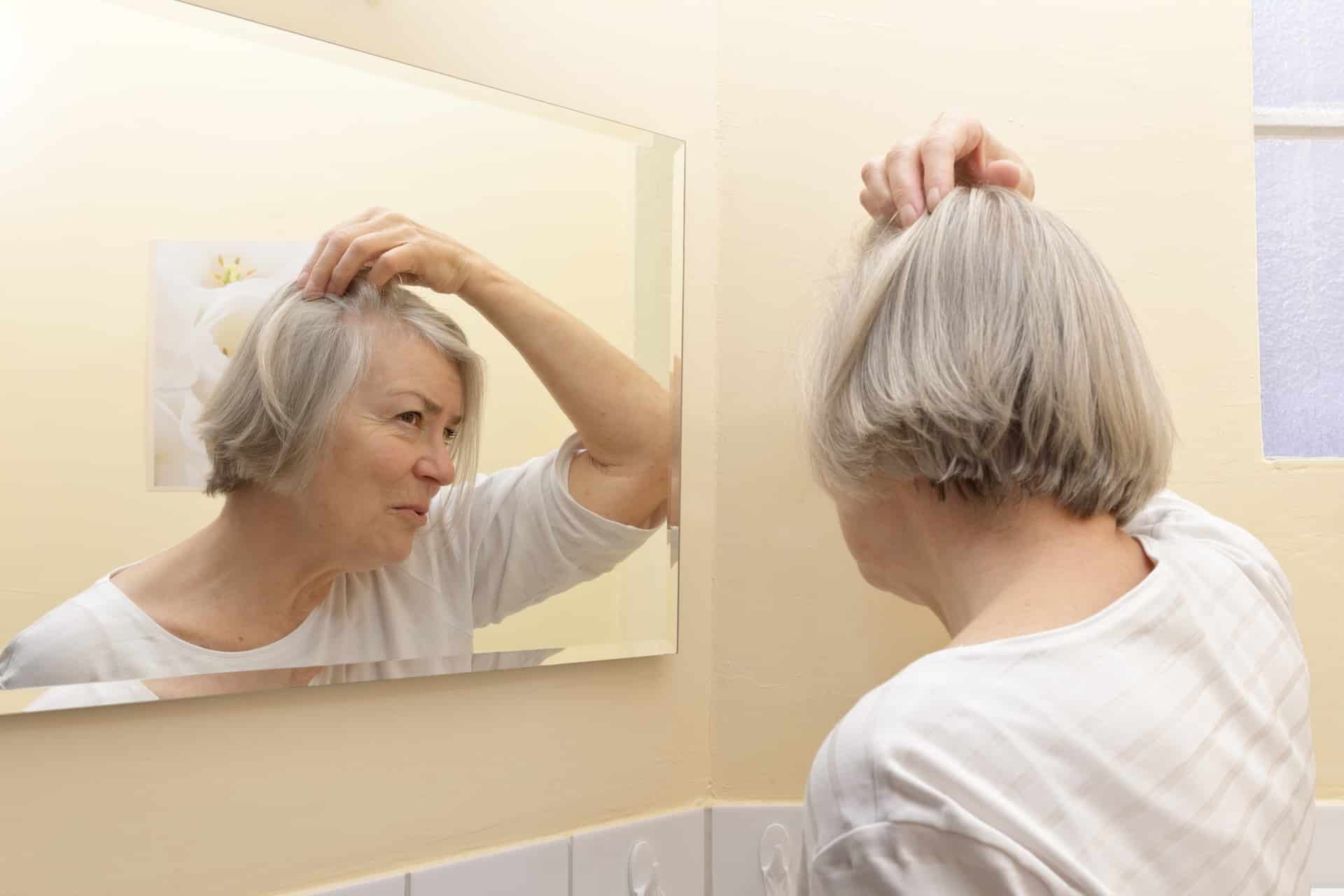 Image of Hair Loss / Alopecia