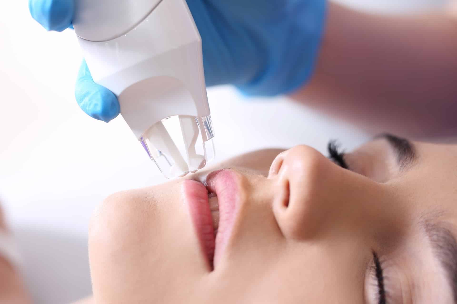 Image of Laser Skin Resurfacing