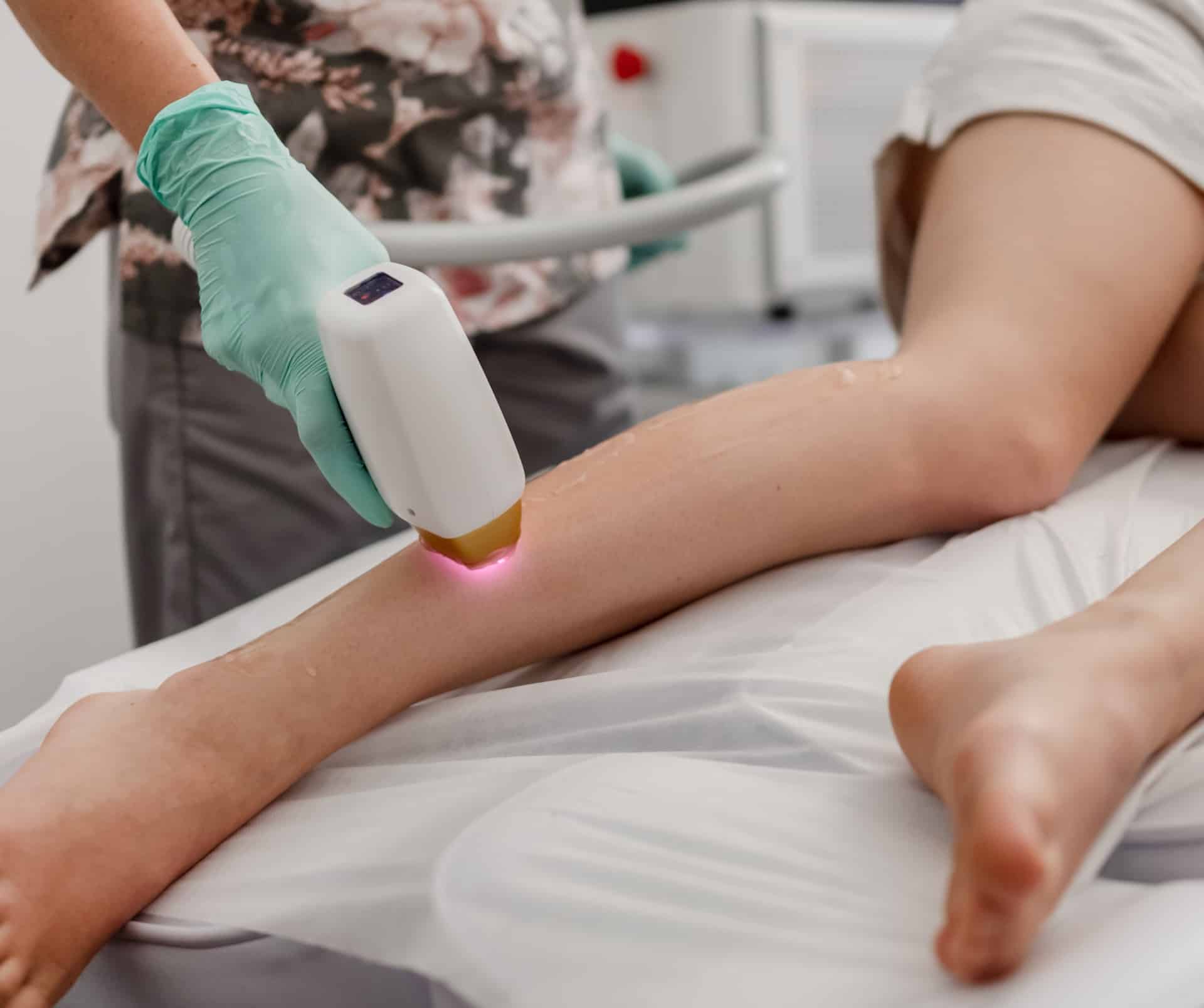 Image of Permanent Hair Removal