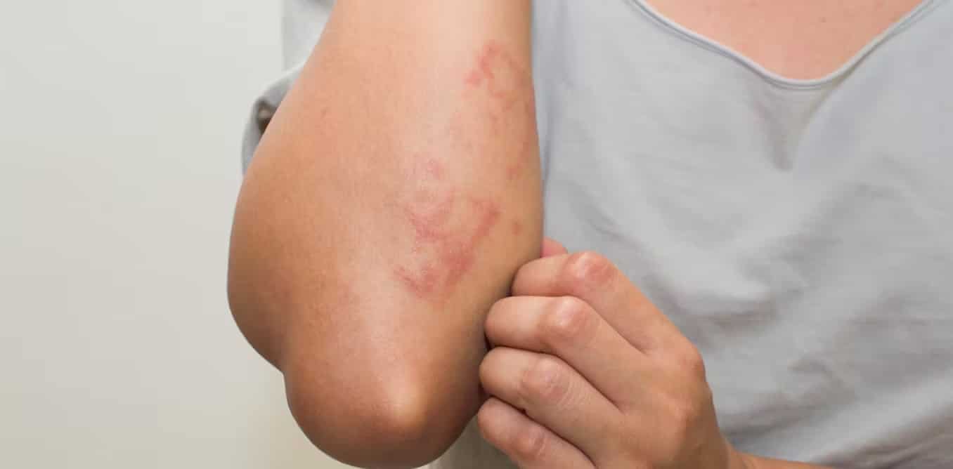 Image of Medical Skin Consultations