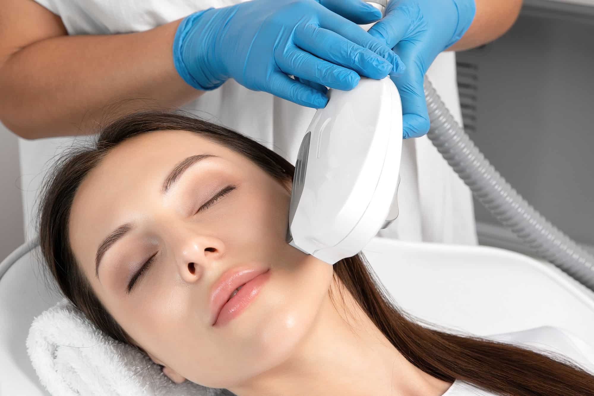 Image of Photorejuvenation (IPL)